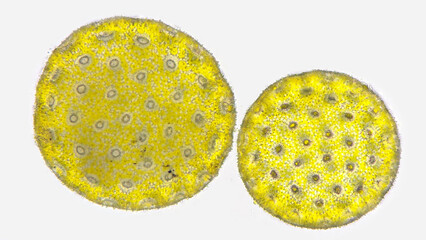 Pollen grains of Four-o-clock or Marvel of Peru (Mirabilis jalapa) under microscope. Fresh sample without staining. Stacked photo