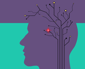 A stroke is illustrated in a circuit in the head of a silhouetted human head and is a 3-d illustration.
