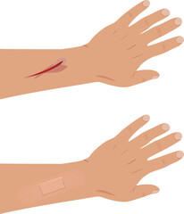 Hand injury patch. vector illustration