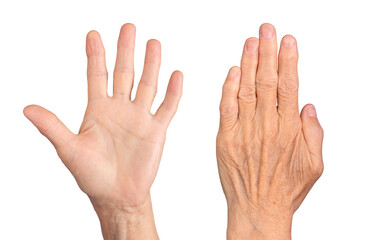 Closeup of elderly caucasian woman's hands, dorsal and palmar views together, fingers spread,...