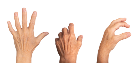 Dorsal view of an elderly woman's hand, outstretched with wrinkled skin and visible veins, fingers spread in an expressive gesture, knuckles prominent. Isolated on white background.