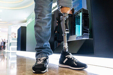 Modern prosthetic leg. Close-up of a man with a prosthetic leg.