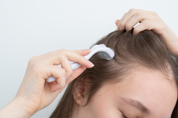 Close up of young woman using microneedling derma roller on head for stimulating new hair growth, copy space for text. Alopecia treatment, scalp stimulation, hair loss and baldness targeted therapy.