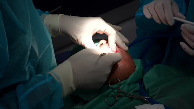 Odontologist cutting patient's gum and opening it during a tooth extraction surgery. Close up