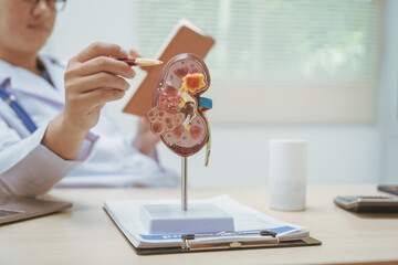 Male doctor treating kidney disease at a hospital table,discussing kidney disease models,diagnosing chronic kidney disease,acute renal failure, nephritis,pyelonephritis,offering online consultations