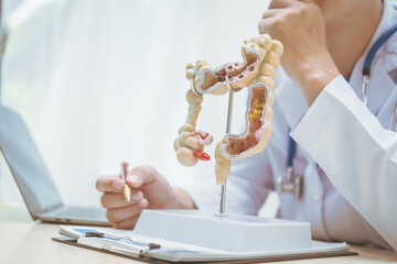 Male doctor treating intestinal diseases at a hospital table, discussing intestinal disease models,...
