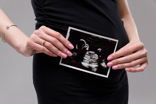 Expecting joy as a mother holds an ultrasound picture signaling new beginnings and love