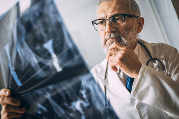 Mature doctor examining the medical x ray image in hospital hallway