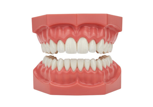 Artificial dental model showing upper and lower teeth in pink gums isolated on white background