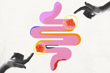 Abstract illustration of digestive system with highlighted areas of concern, surrounded by monochrome pointing hands. Conceptual art design. Medicine, treatment, health care, medical science concept