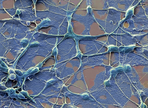 Neurones, SEM