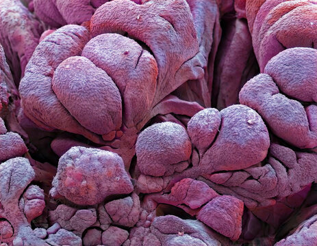 Fallopian tube, SEM