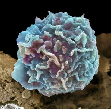 Macrophage, SEM