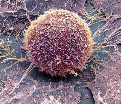 Hela cell, SEM