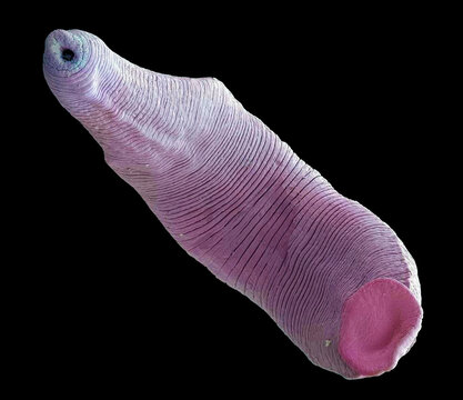 Freshwater leech, SEM