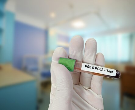 Technologist hold test tube with blood sample for PO2 & PCO2 test. Healthcare and medical concept.