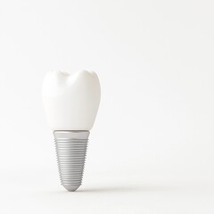 Realistic Dental Implant Model with a White Crown on a Light Background for Educational and Medical Purposes in Dentistry