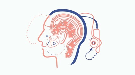 Cochlear Implant Device Flat Vector Illustration