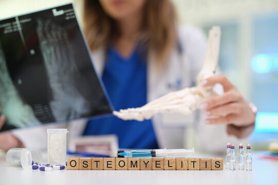 A qualified healthcare professional assesses osteomyelitis using Xray and an anatomical foot model for accuracy