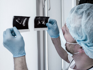 X-ray adenoma prostate cancer in doctor's hands. The doctor diagnoses an ultrasound of prostate adenoma in a man in the clinic. Urologist studies the disease of the genitourinary system