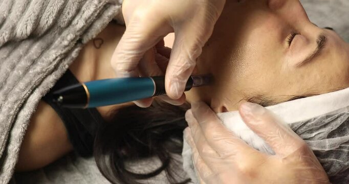 beautiful young woman on a facial dermapen micro-needling treatment at the beauty salon. Woman is getting a facial treatment with a device.