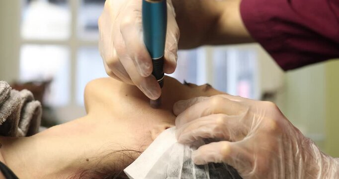 beautiful young woman on a facial dermapen micro-needling treatment at the beauty salon. Woman is getting a facial treatment with a device.