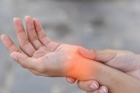 Fototapeta Wrist affected by a medical condition, showing visible signs of inflammation, swelling, or discomfort. Pain, injury, or arthritis, carpal tunnel syndrome, or tendonitis.