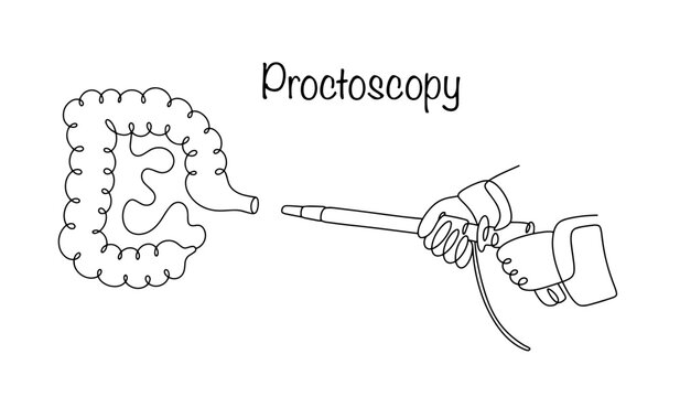 Proctoscopy