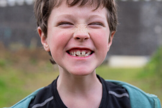 Child's Joyful Expression With Missing Tooth Outdoors in bike day