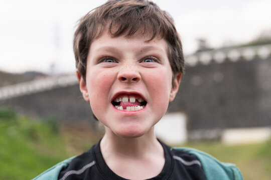 Young boy making a fierce face with visible missing tooth in bike day