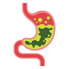 Human stomach vector illustration. Depicts gastritis, acid reflux, indigestion, heartburn, and stomach pain problems. Concept of illness, discomfort, and unhealthy stomach.