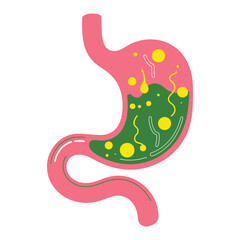 Human stomach vector illustration. Depicts gastritis, acid reflux, heartburn, and stomach pain problems. Concept of illness, discomfort, and unhealthy stomach.