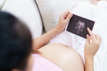 Pregnant woman is looking at ultrasound image with love and happy.