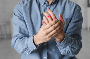 Man with joint inflammation indoors, closeup. Red areas on fingers
