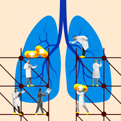 Team of doctors working on lung diagram with pills and scaffolding, representing teamwork in...