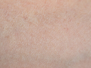 A macro shot of human skin showing the detailed structures, texture and saturation of natural hues.