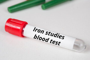 Iron studies blood test name of blood test