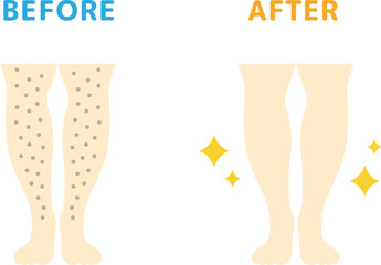 足脱毛の、ビフォーアフターのアイコンのイラスト