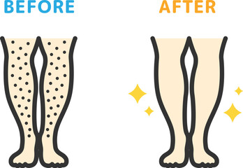 足脱毛の、ビフォーアフターのアイコン（線画カラー）のイラスト