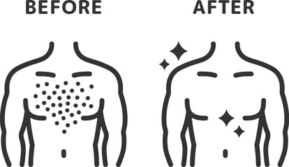 胸毛脱毛の、ビフォーアフターのアイコン（線画）のイラスト
