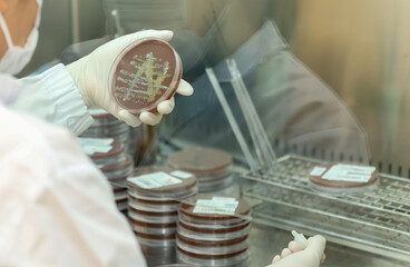 Scientist examining bacterial cultures in Gonorrhea testing through bacterial culturing involves...