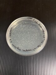 Petri dish with white colonies, petri plate, plate with culture medium, culture medium.