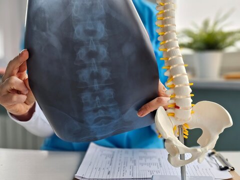 Scoliosis spine watching image of chest at x-ray film viewer - Powered by Adobe