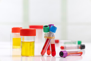 health-care and medicine symbol - Urine Sample and Blood Test