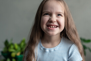 Caucasian young girl smiling with missing teeth in striped shirt indoors