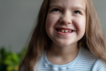 Smiling caucasian female child with missing tooth in striped shirt