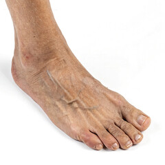 Close Up Of An Old Man's Foot With Veins Isolated On White Background