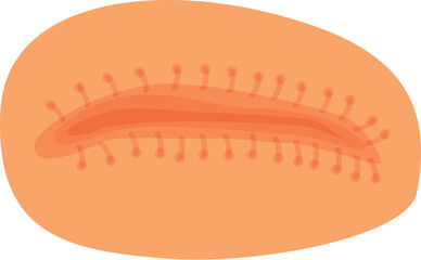 Closed surgical wound with sutures, showing healing process after medical procedure