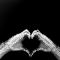 Obraz premium x-ray image of hands making heart symbols. Valentine day concept