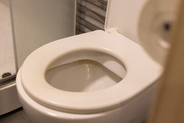 Close-up of dirty rim of the toilet bowl.